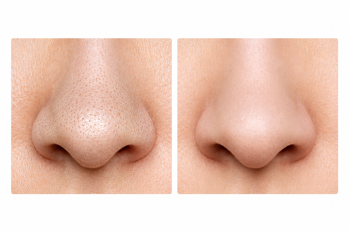 Valoré™ Volcano Clay Mask Stick