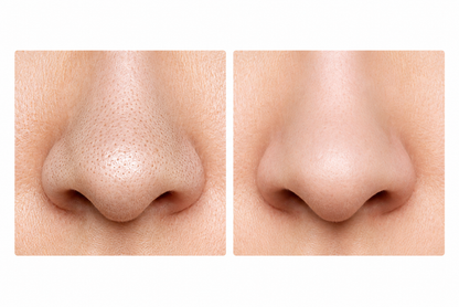 Valoré™ Volcano Clay Mask Stick